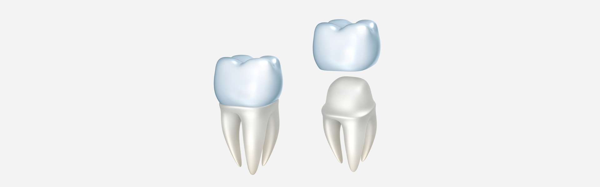 Dental Crowns in Phoenix, AZ