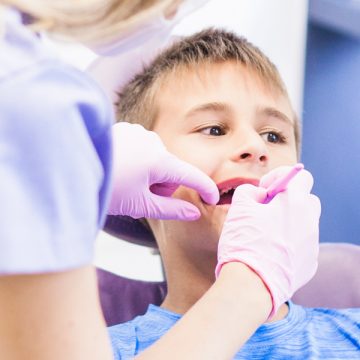 Dental Sealants a Protective Barrier on Kids Molars to Prevent Cavities